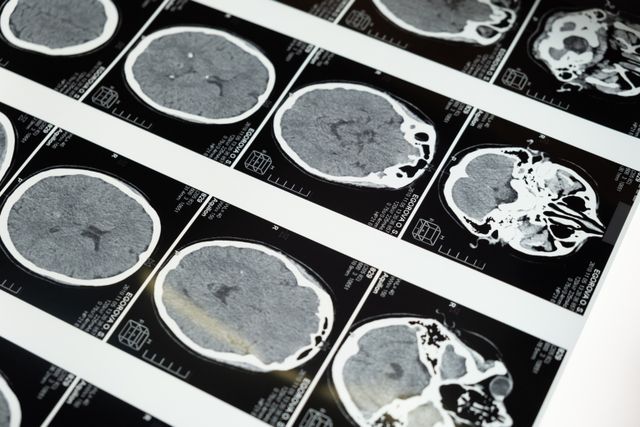 Brain Scan